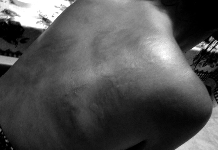 IMG_20170312_195301317 (1)